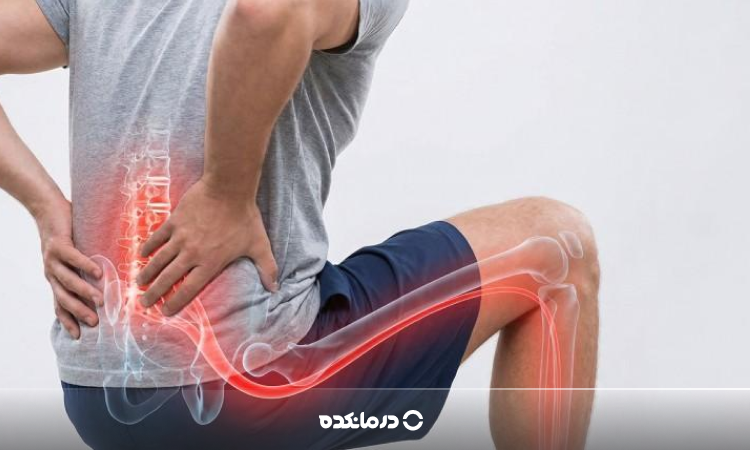 درد سیاتیک چقدر طول میکشد؟ چند روز درد طبیعی است و چرا طولانی میشود؟