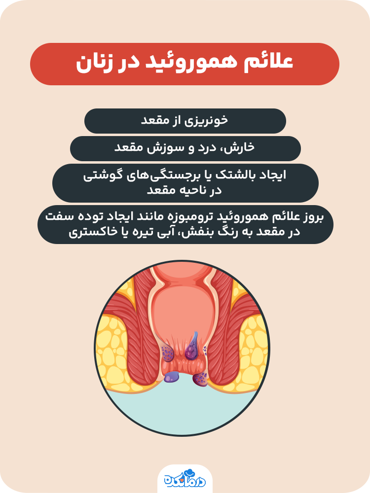  اینفوگرافیک علائم هموروئید در زنان
