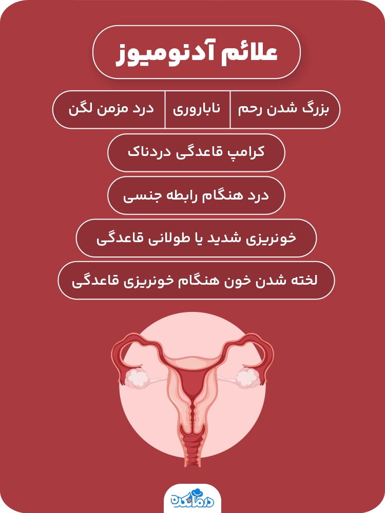 اینفوگرافی درباره علائم آدنومیوز