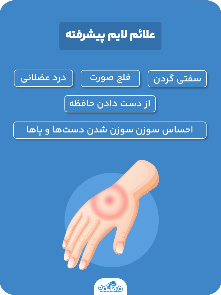  اینفوگرافیک علائم بیماری لایم پیشرفته