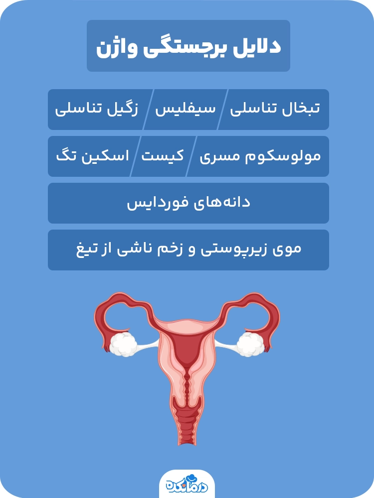 اینفوگرافی در مورد دلایل برجستگی واژن