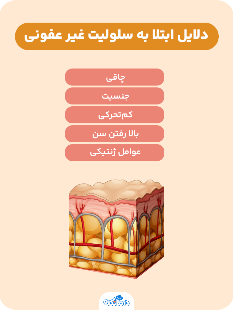 اینفوگرافی در مورد دلایل ابتلا به سلولیت غیر عفونی