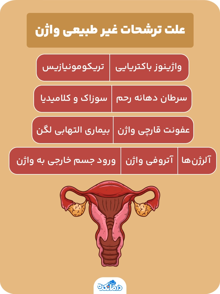 اینفوگرافی «علت ترشحات غیر طبیعی واژن»