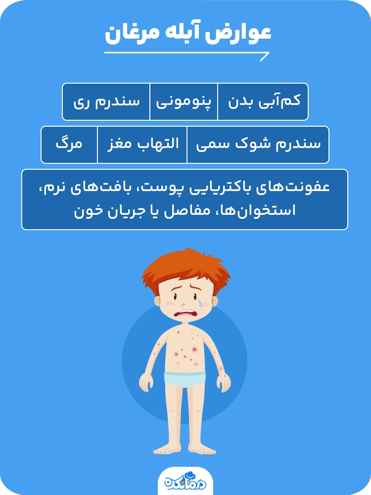 اینفوگرافیک عوارض آبله مرغان