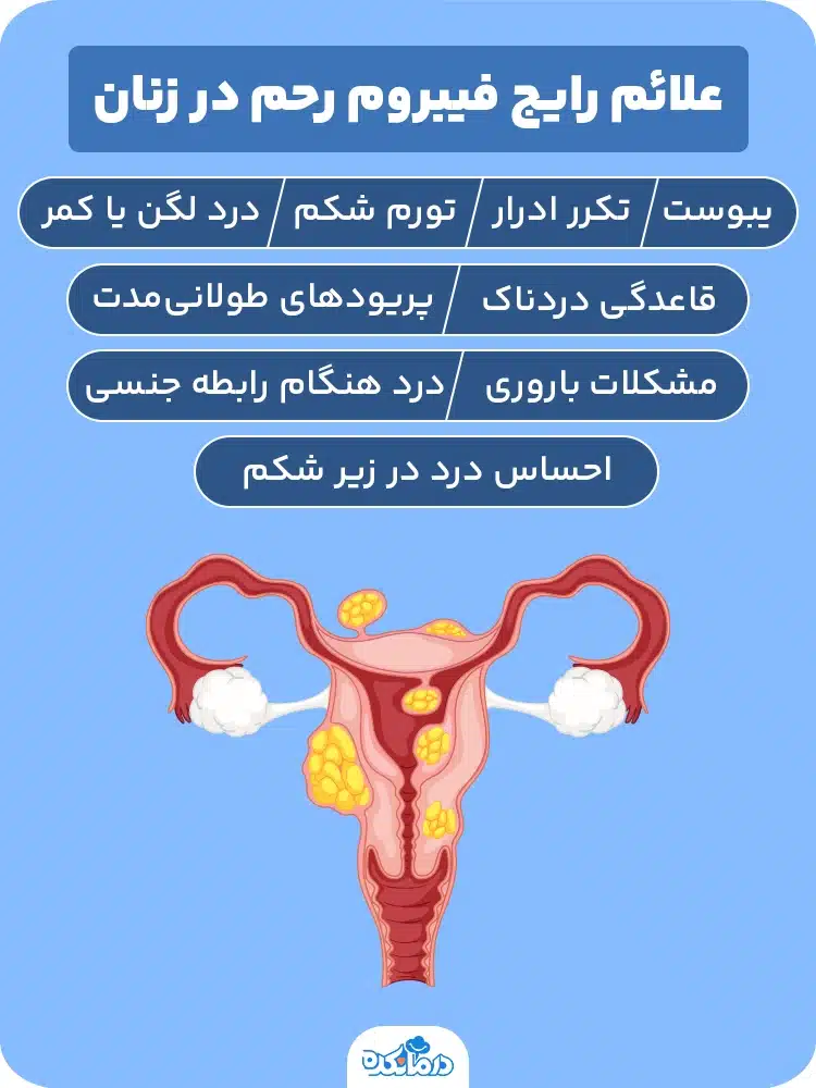  اینفوگرافیک علائم رایج فیبروم رحم در زنان