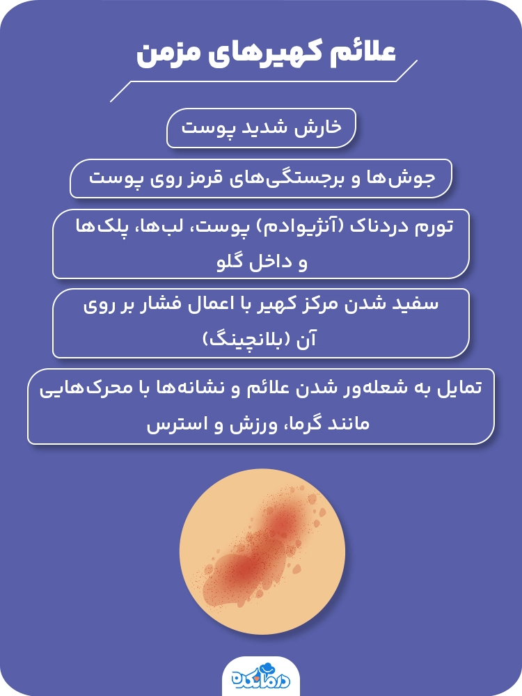 اینفوگرافیک علائم کهیرهای مزمن