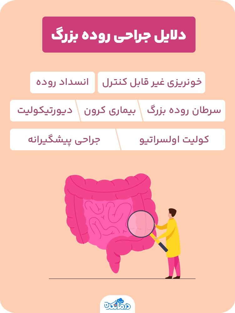 اینفوگرافی درباره دلایل عمل روده بزرگ