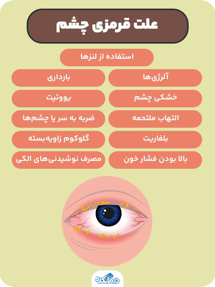 اینفوگرافیک علت قرمزی چشم