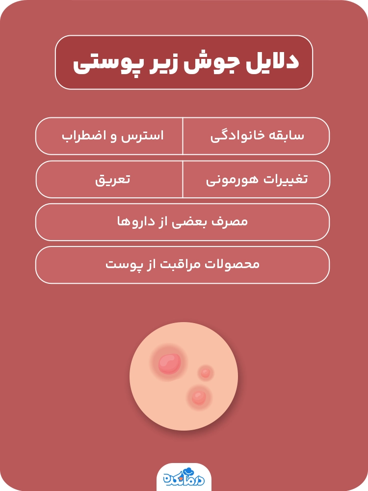 اینفوگرافی در مورد دلایل جوش زیر پوستی